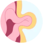 hernias dr. luis rojas