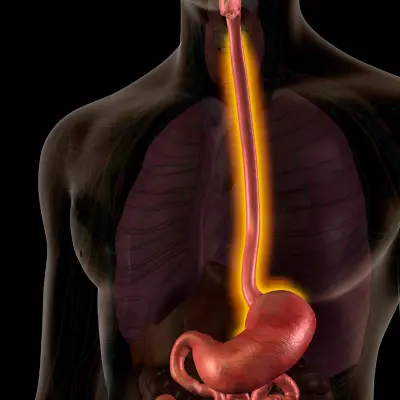 tracto gastrointestinal en morelia