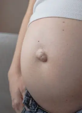 Cirugía de Hernia Umbilical en Morelia